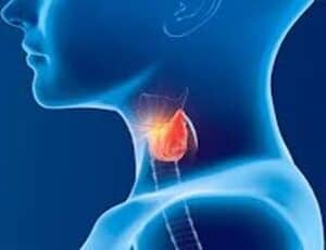 Rugby PLT May 2023 - Endocrinology